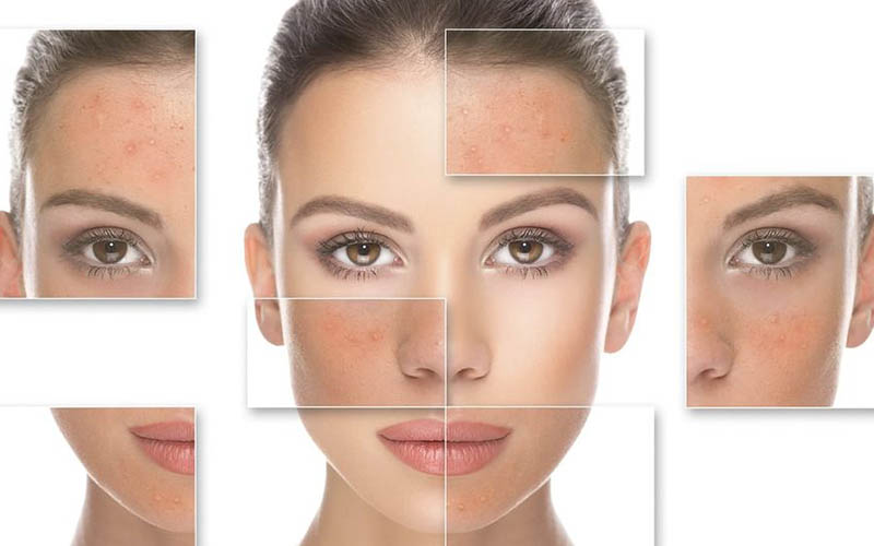 Детальніше про статтю Чи може косметика лікувати дерматологічні захворювання